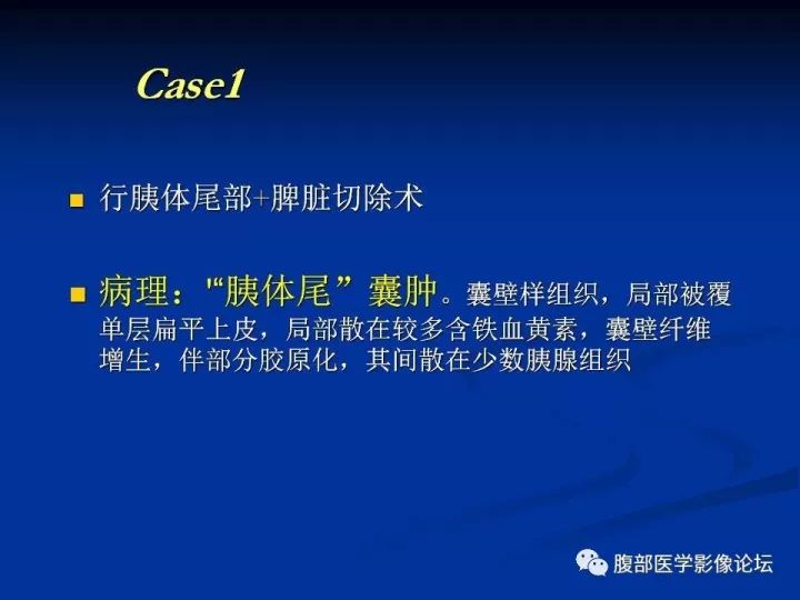 【病例】胰腺尾部囊性占位两例-胰腺囊肿VS副脾表皮样囊肿CT