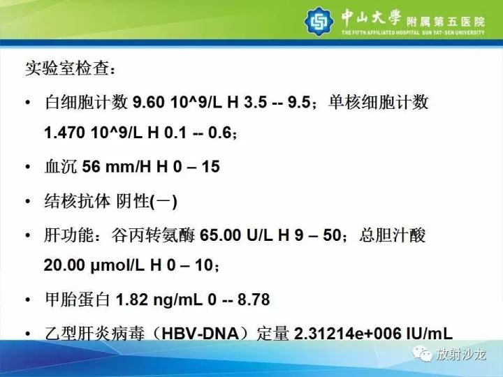 【病例】骶骨结核1例X线CT及MR