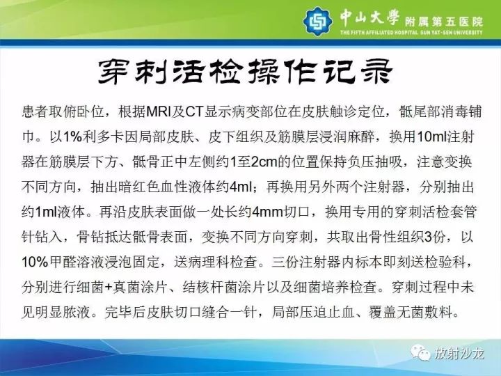 【病例】骶骨结核1例X线CT及MR