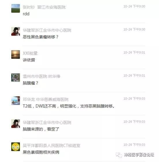 【病例】中枢神经系统Rosai-Dorfman病RDD一例影像讨论 【病例】中枢神经系统Rosai-Dorfman病RDD一例影像讨论
