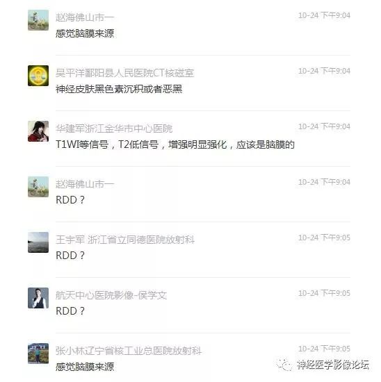 【病例】中枢神经系统Rosai-Dorfman病RDD一例影像讨论 【病例】中枢神经系统Rosai-Dorfman病RDD一例影像讨论