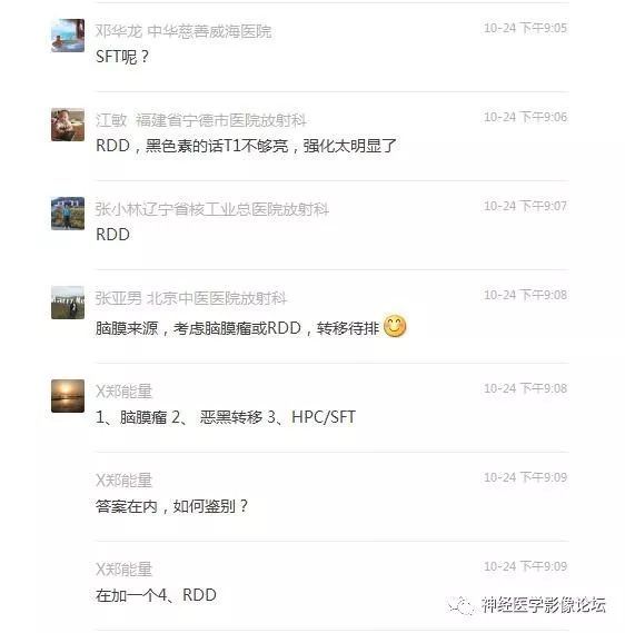 【病例】中枢神经系统Rosai-Dorfman病RDD一例影像讨论 【病例】中枢神经系统Rosai-Dorfman病RDD一例影像讨论