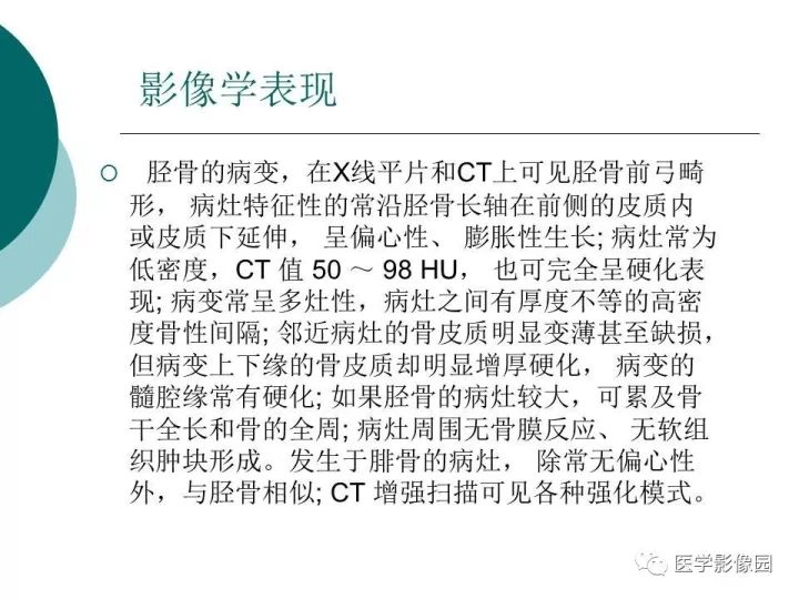 【病例】胫骨骨纤维异常增殖症1例CT及MR