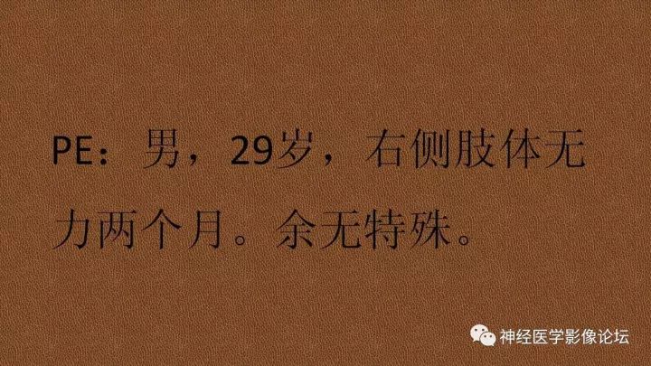 【病例】脑实质淀粉瘤1例MR影像表现