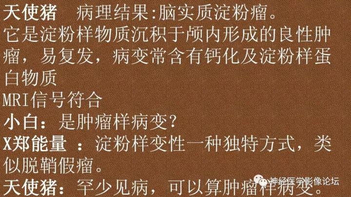 【病例】脑实质淀粉瘤1例MR影像表现