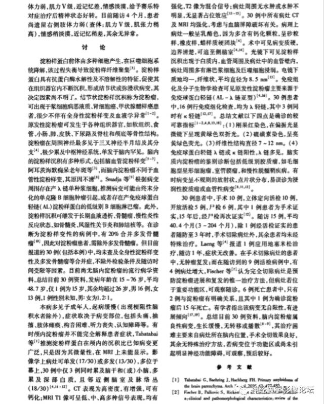 【病例】脑实质淀粉瘤1例MR影像表现