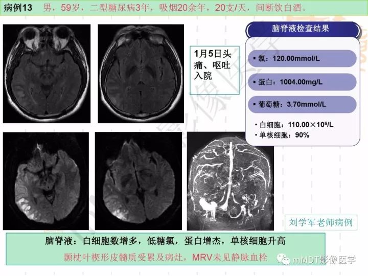 【PPT】中枢神经系统血管炎(CNSV)的表现与特征