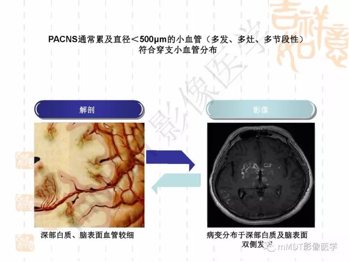 【PPT】中枢神经系统血管炎(CNSV)的表现与特征