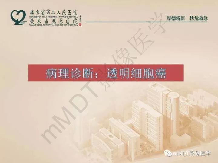 【PPT】卵巢肿瘤读片