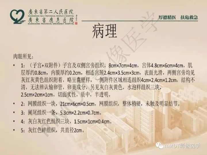 【PPT】卵巢肿瘤读片