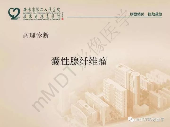 【PPT】卵巢肿瘤读片