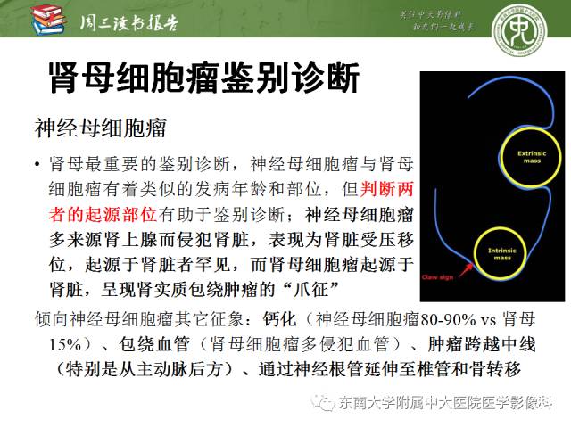 【PPT】儿童肾肿瘤：影像-病理相关性第一部分(0 ~ 10岁)