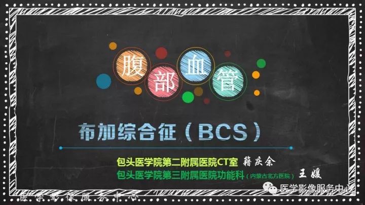 【PPT】布加综合征