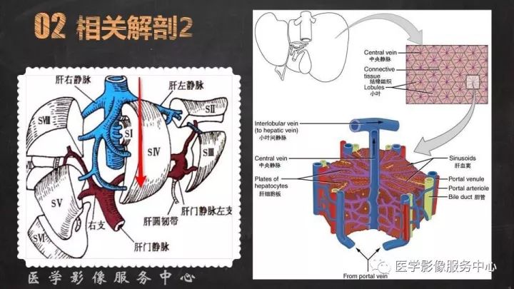 【PPT】布加综合征