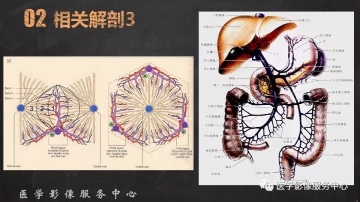 【PPT】布加综合征