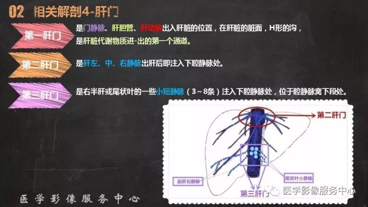 【PPT】布加综合征