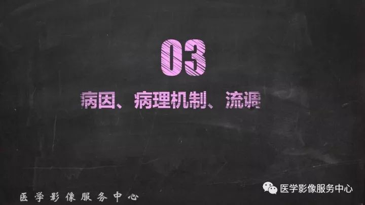 【PPT】布加综合征