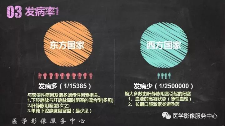 【PPT】布加综合征