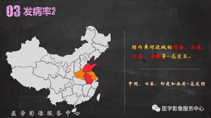 【PPT】布加综合征