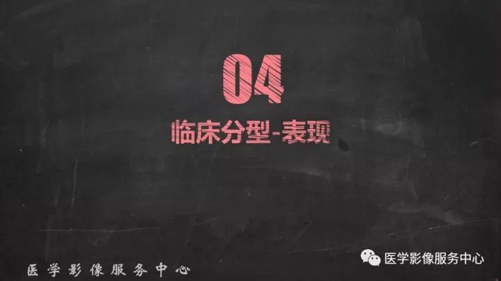 【PPT】布加综合征