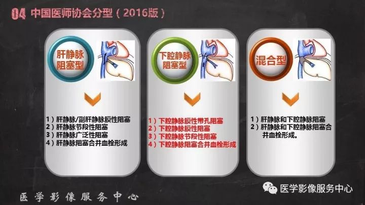 【PPT】布加综合征