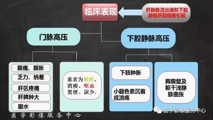 【PPT】布加综合征