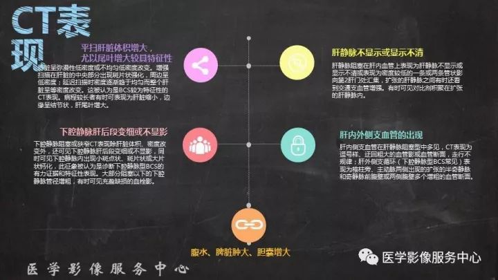 【PPT】布加综合征