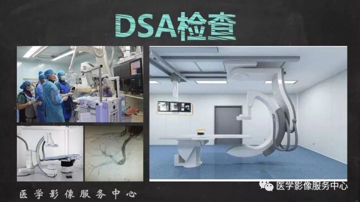 【PPT】布加综合征