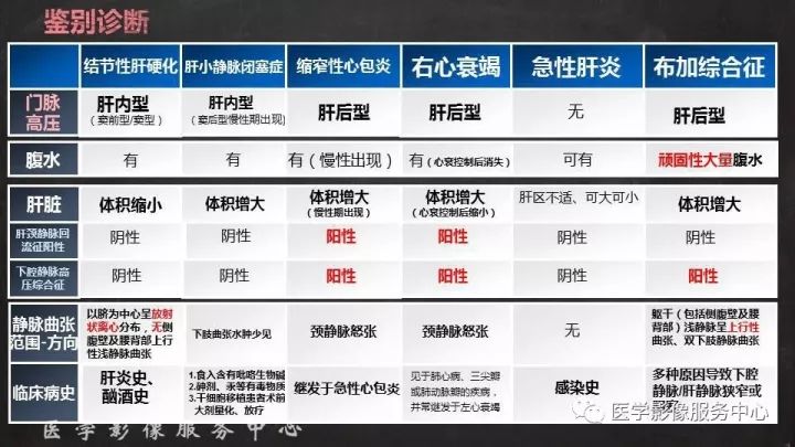 【PPT】布加综合征