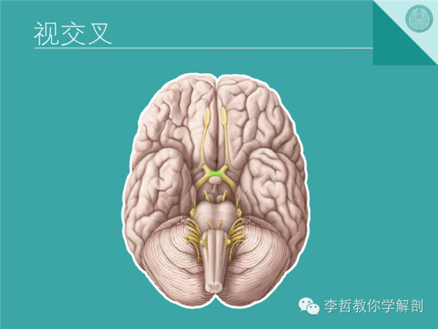 【PPT】12对颅神经影像检查