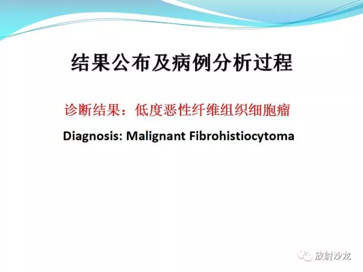 【病例】上颌窦低度恶性纤维组织细胞瘤1例MR