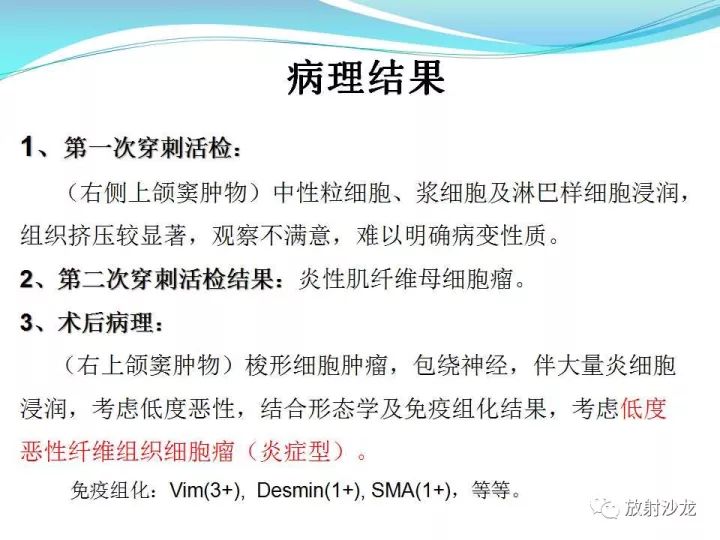 【病例】上颌窦低度恶性纤维组织细胞瘤1例MR