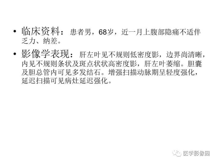 【病例】肝内胆管细胞癌1例CT影像表现