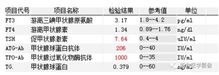 【病例】甲状腺乳头状癌1例CT影像表现 【病例】甲状腺乳头状癌1例CT影像表现