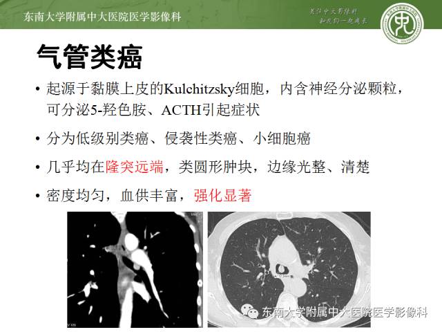 【病例】气管肿瘤2例CT影像诊断 【病例】气管肿瘤2例CT影像诊断