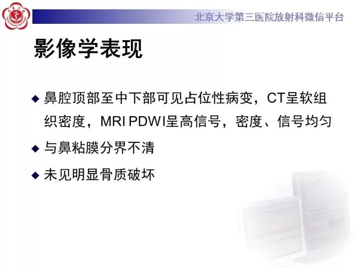 【病例】鼻腔嗅神经母细胞瘤1例CT及MR影像