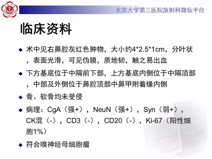 【病例】鼻腔嗅神经母细胞瘤1例CT及MR影像