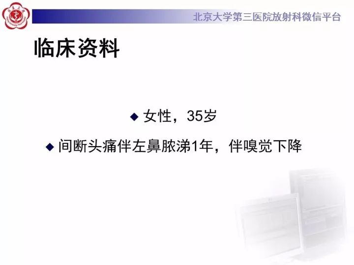 【病例】鼻腔嗅神经母细胞瘤1例CT及MR影像