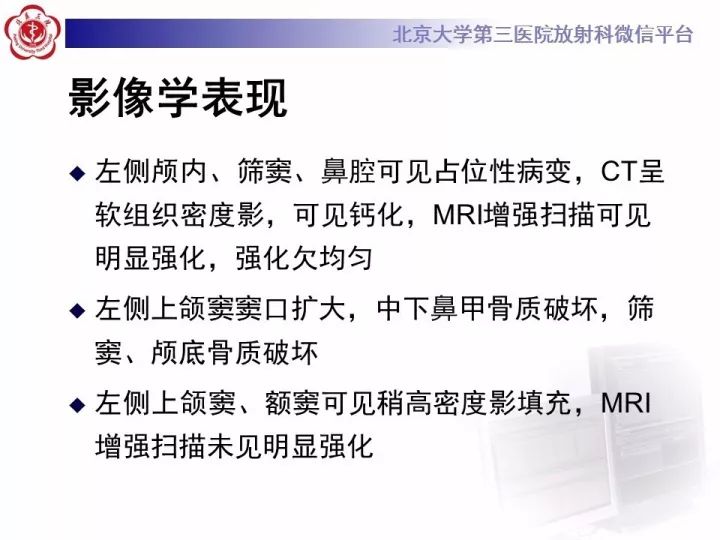 【病例】鼻腔嗅神经母细胞瘤1例CT及MR影像
