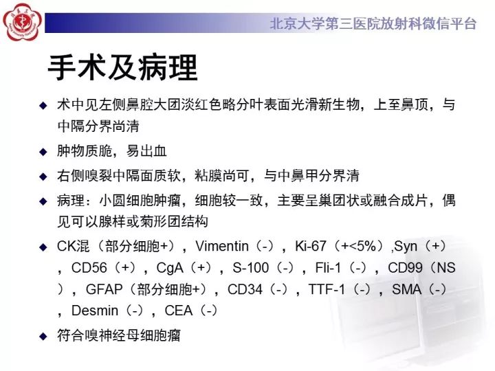 【病例】鼻腔嗅神经母细胞瘤1例CT及MR影像