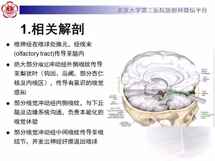 【病例】鼻腔嗅神经母细胞瘤1例CT及MR影像