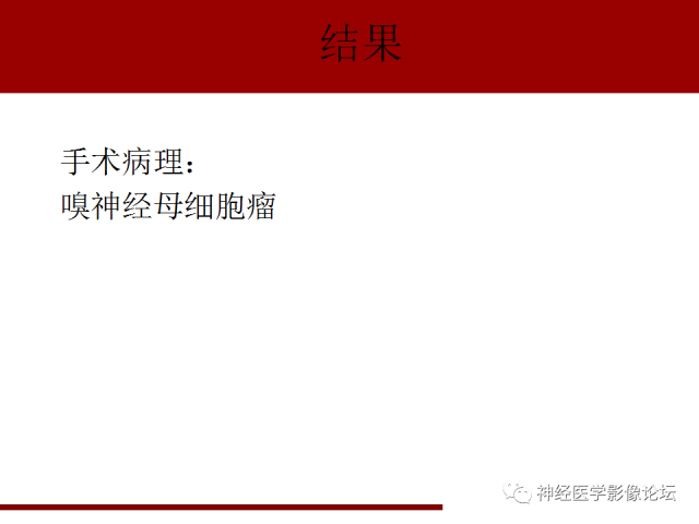 【病例】鼻颅沟通肿瘤——嗅神经母细胞瘤一例MR