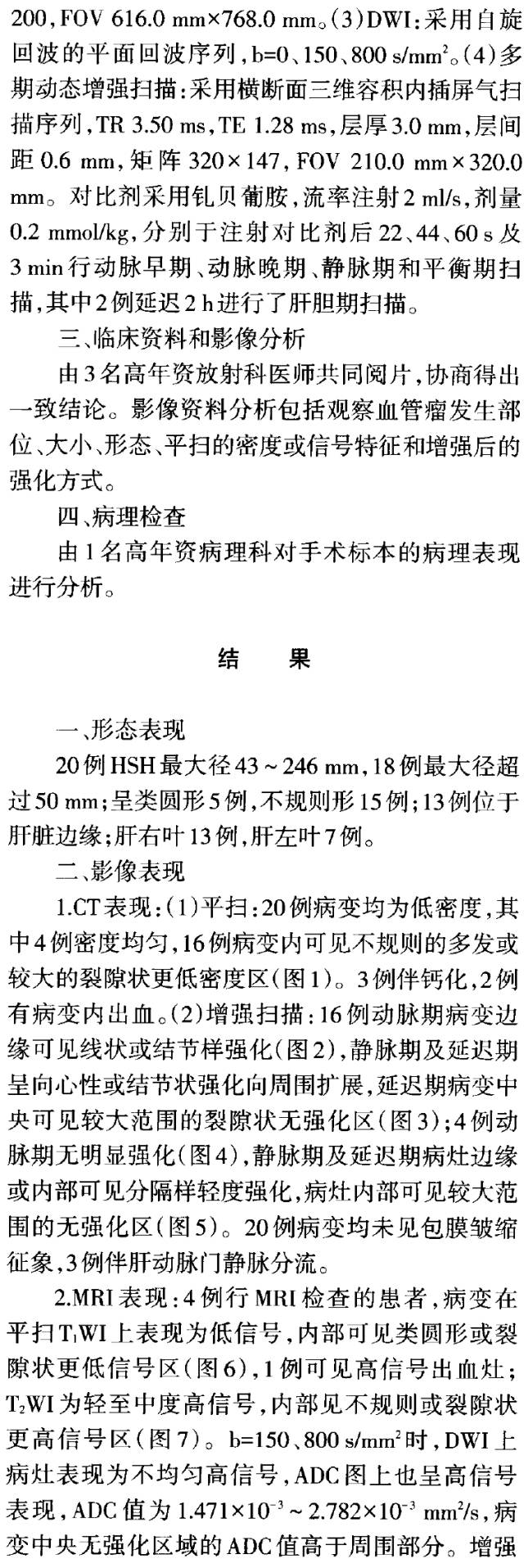 【病例】肝脏硬化性血管瘤1例CT及MRI表现