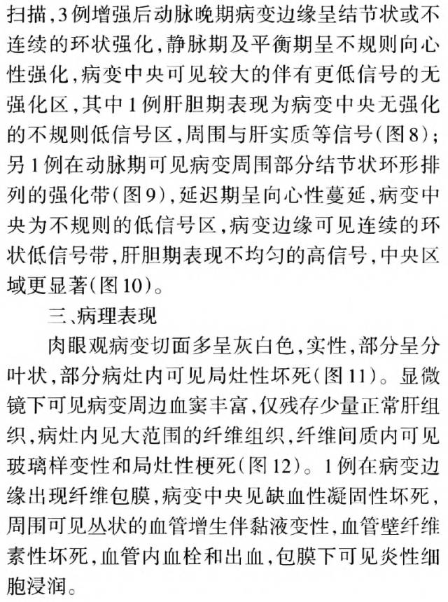 【病例】肝脏硬化性血管瘤1例CT及MRI表现