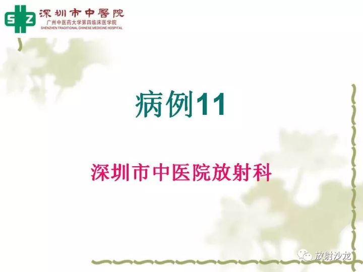 【病例】左侧眶尖血管外皮细胞瘤1例CT及MR