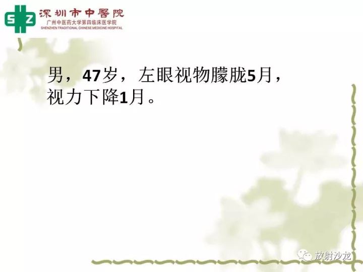 【病例】左侧眶尖血管外皮细胞瘤1例CT及MR