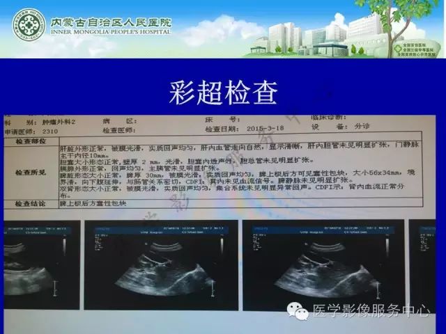 【罕见病例】全球仅22例的深在性囊性胃炎1例CT影像