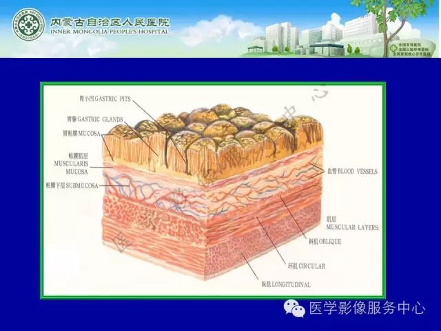 【罕见病例】全球仅22例的深在性囊性胃炎1例CT影像