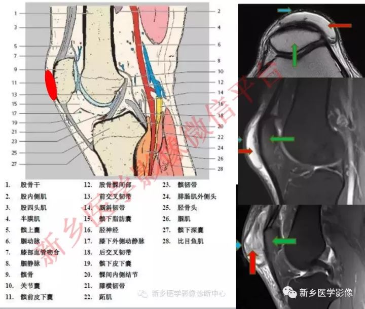 膝关节的15个滑囊解剖