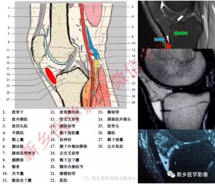 膝关节的15个滑囊解剖